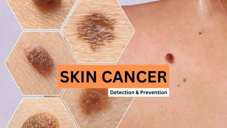 Skin Cancer is commonly found in people