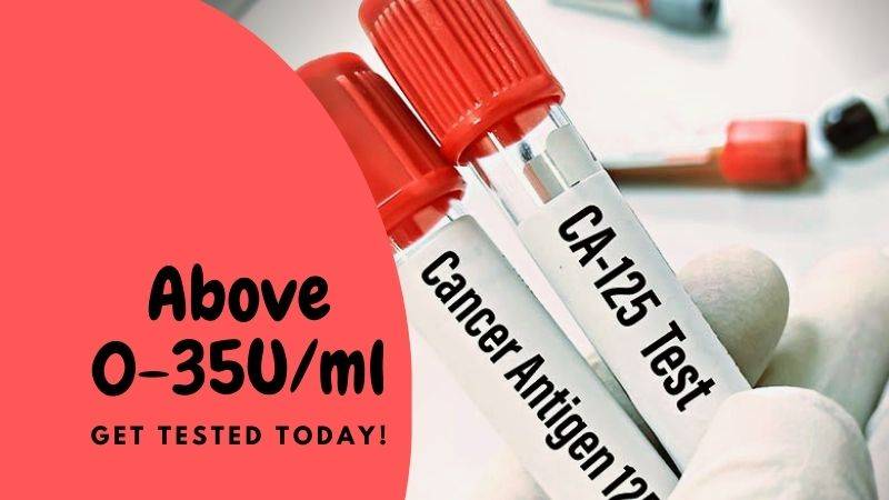 CA125 level above 35- get tested today