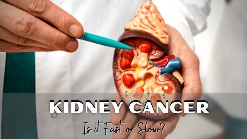 Does Kidney Cancer Fast or Slow