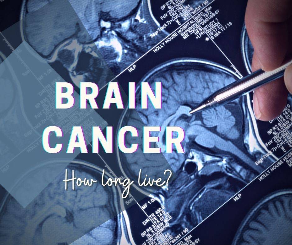 Brain cancer- How long live?