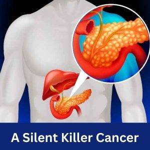 PCa- a silent killer cancer