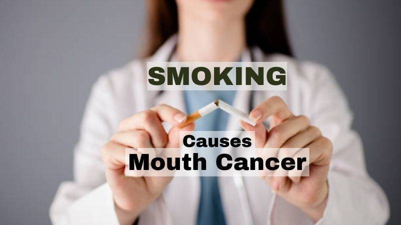 SMOKING causes Mouth Cancer