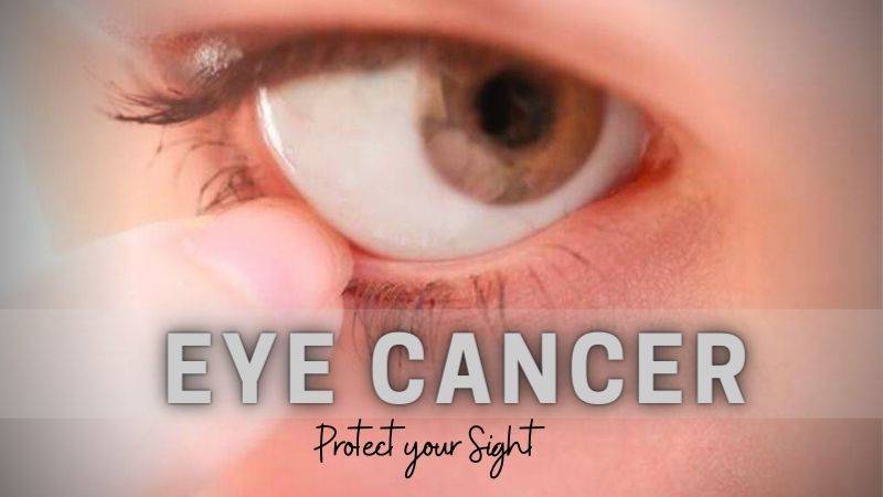 eye cancer detection