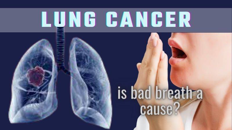 lung cancer-is bad breathe a cause