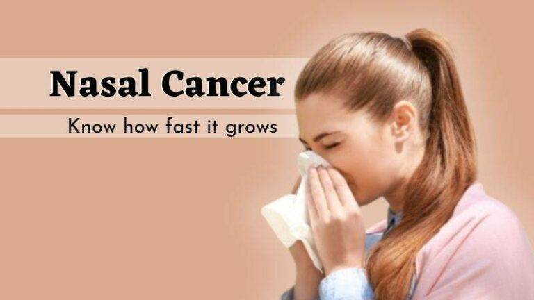 nasal-cavity-cancer