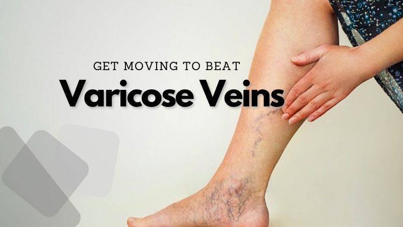 Varicose Veins-causes, types, treatments