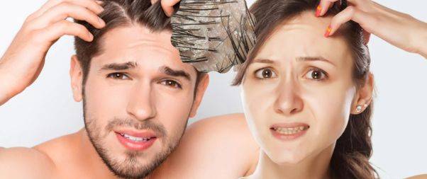 Factors and Causes of Dandruff