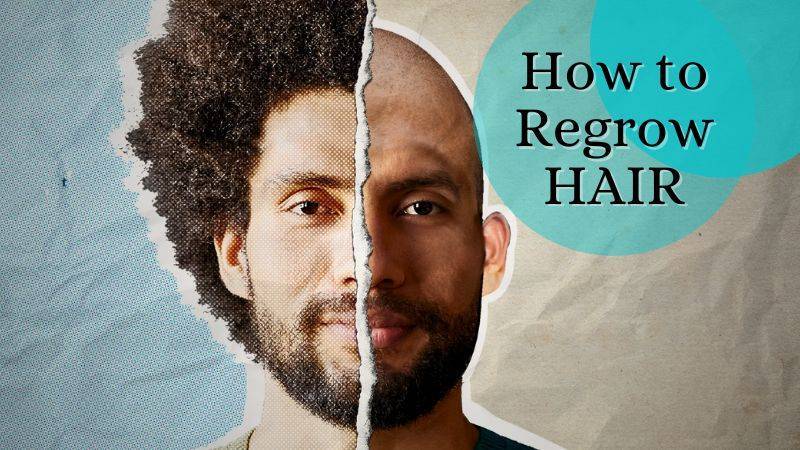How to Regrow hair on a bald spot