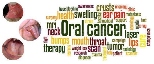 Prevention of oral cancer