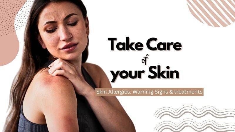 Take Care of your Skin-Skin Allergies, Symptoms & Treatments