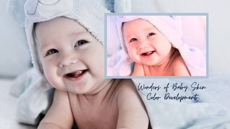 Wonders of Baby Skin Color Development