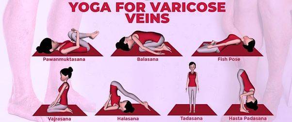 Yoga for Varicose veins