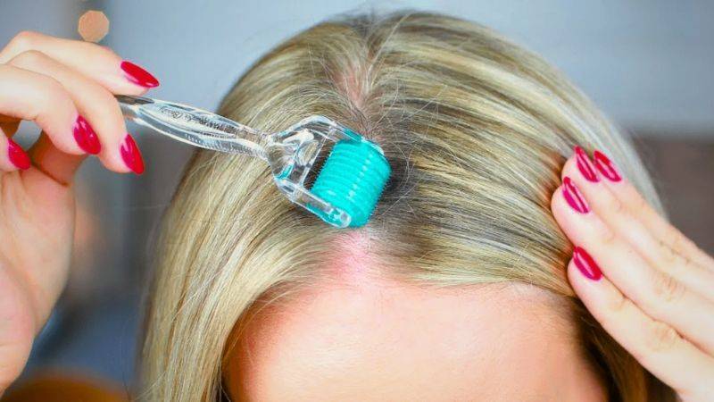 Derma Roller: How to use & what are the benefits?