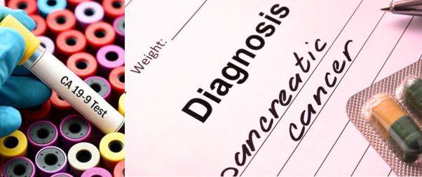 Diagnosis of Pancreatic cancer