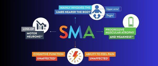 SMA- Causes & Symptoms
