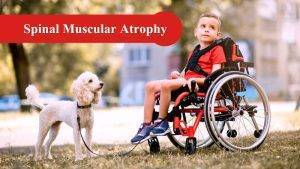 Spinal Muscular Atrophy