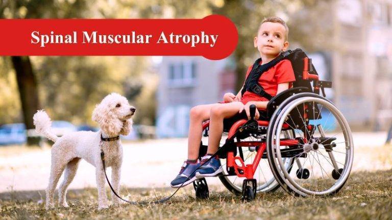 Sma Spinal Muscular Atrophy A Rare Disease