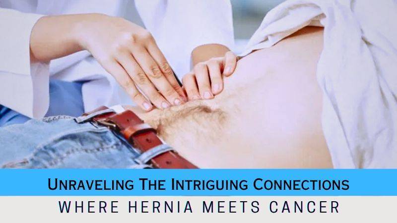 Unraveling The Intriguing Connections-Hernia & Cancer