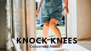 Knock Knees- Best Exercises