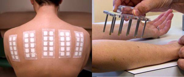 Different types of Allergy Testing
