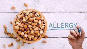 Peanut Allergy | Causes | Symptoms | Treatment |