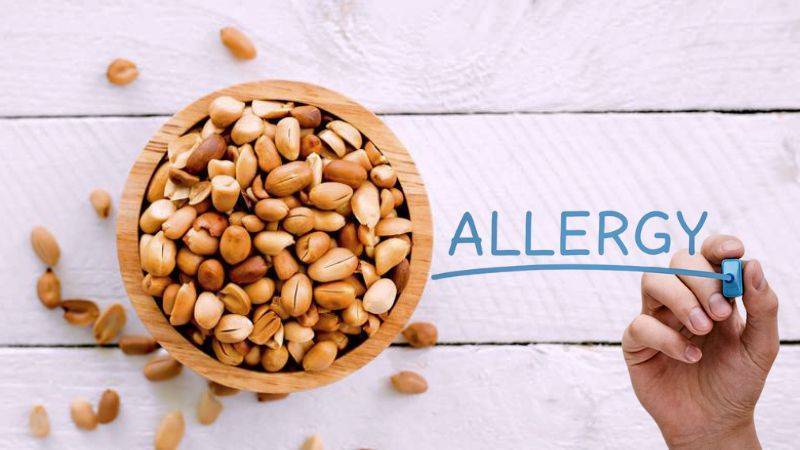 Peanut Allergy | Causes | Symptoms | Treatment |