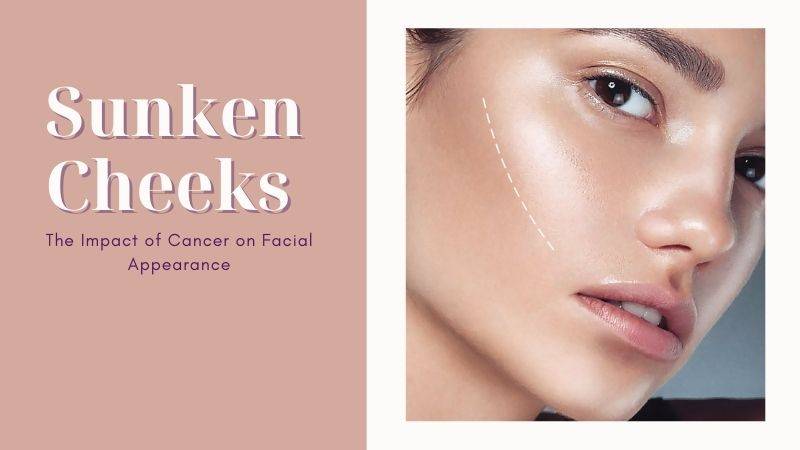 Connection between Sunken Cheeks and Cancer