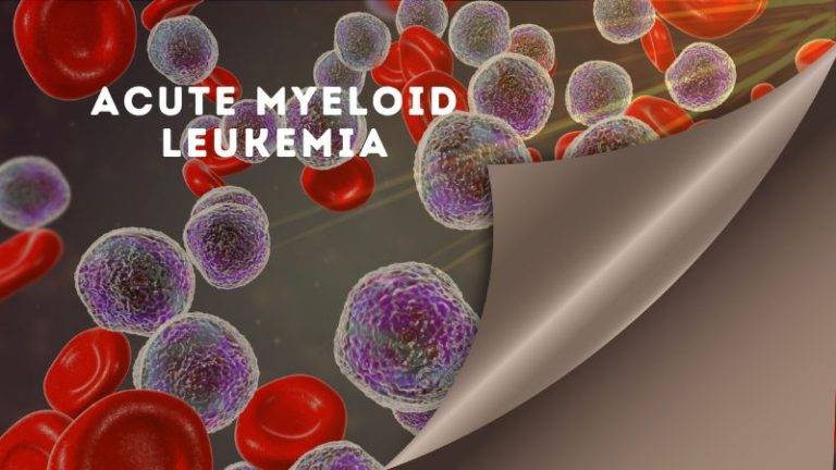 Acute Myeloid Leukemia: Causes, Symptoms, and Treatment