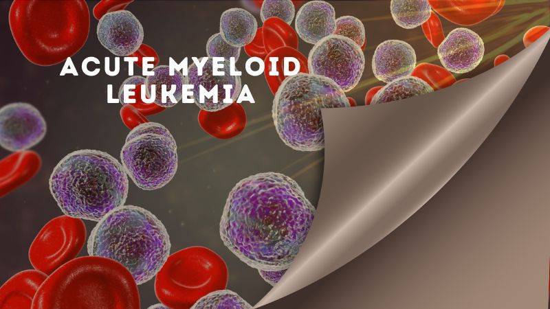 Acute Myeloid Leukemia | Causes | Symptoms | Treatment |