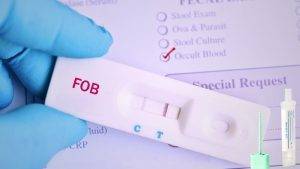 Fecal Occult Blood Test | Significance | Risks |