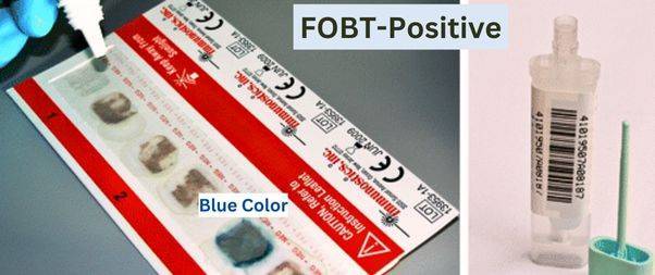 Fecal Occult Blood Test-Positive Significance