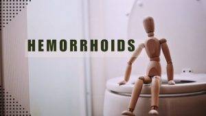 Hemorrhoids or Piles