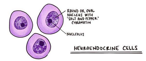 Neuroendromine Cells