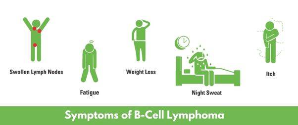 Symptoms of B-Cell Lymphoma