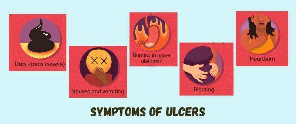 Symptoms of Ulcers