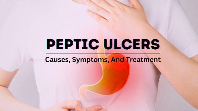 Ulcers: Causes, Symptoms, and Treatment