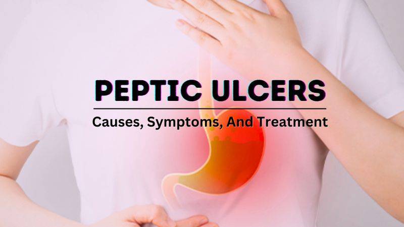 Ulcers: Causes, Symptoms, And Treatment