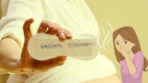 Vaginal Discharge Smell