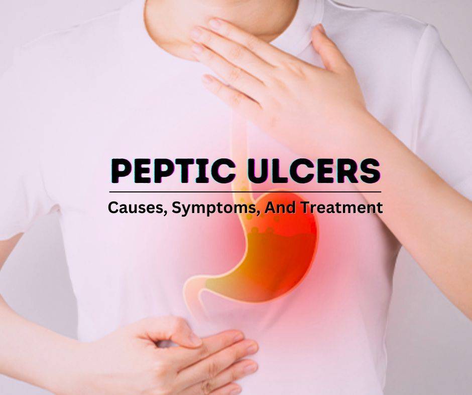 ulcers-causes-symptoms-and-treatment